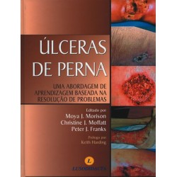 Úlceras de Perna, Uma Abordagem de Aprendizagem Baseada na Resolução de Problemas