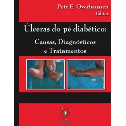 Úlceras do Pé Diabético, Causas, Diagnósticos e Tratamentos