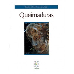 Queimaduras