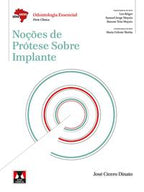 Noções de Prótese Sobre Implante