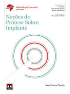 Noções de Prótese Sobre Implante